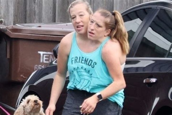 Exploring the Remarkable Lives of Abby and Brittany Hensel: A Unique Perspective on Life and Independence