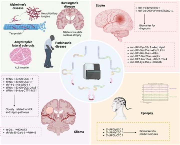Understanding ATPL Brain Disease: Causes, Symptoms, and Treatment Options