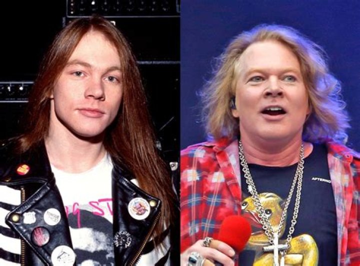 Axl Rose Now: The Journey of a Rock Legend