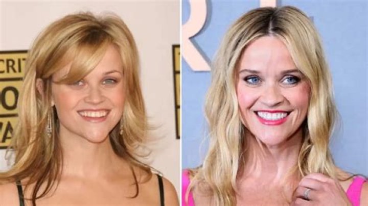 Celebrities with Overbites: A Closer Look at Their Unique Smiles