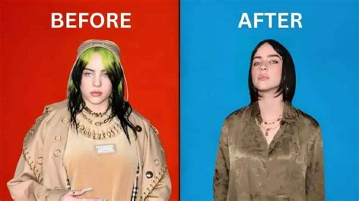 Did Billie Eilish Have a Breast Reduction? Everything You Need to Know