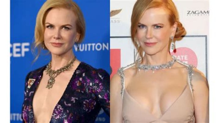 Does Nicole Kidman Have Breast Implants? Unveiling the Truth
