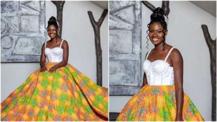 Fantana Before Surgery: A Comprehensive Look at Her Journey