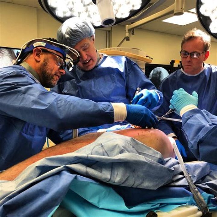 Fantana Surgery: A Comprehensive Guide to Understanding and Exploring the Procedure