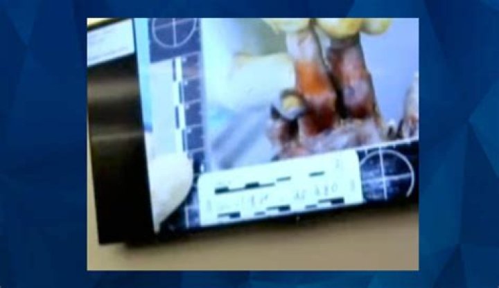 Gannon Stauch Autopsy: Unveiling the Facts and Insights