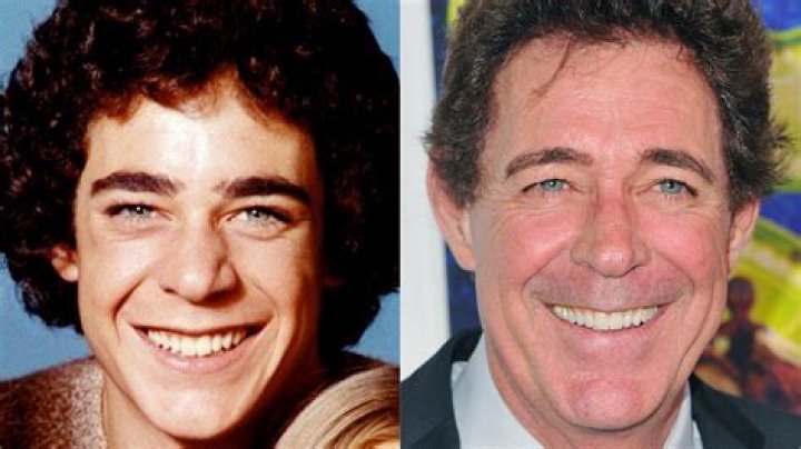 Greg Brady: The Iconic Teen Star of The Brady Bunch