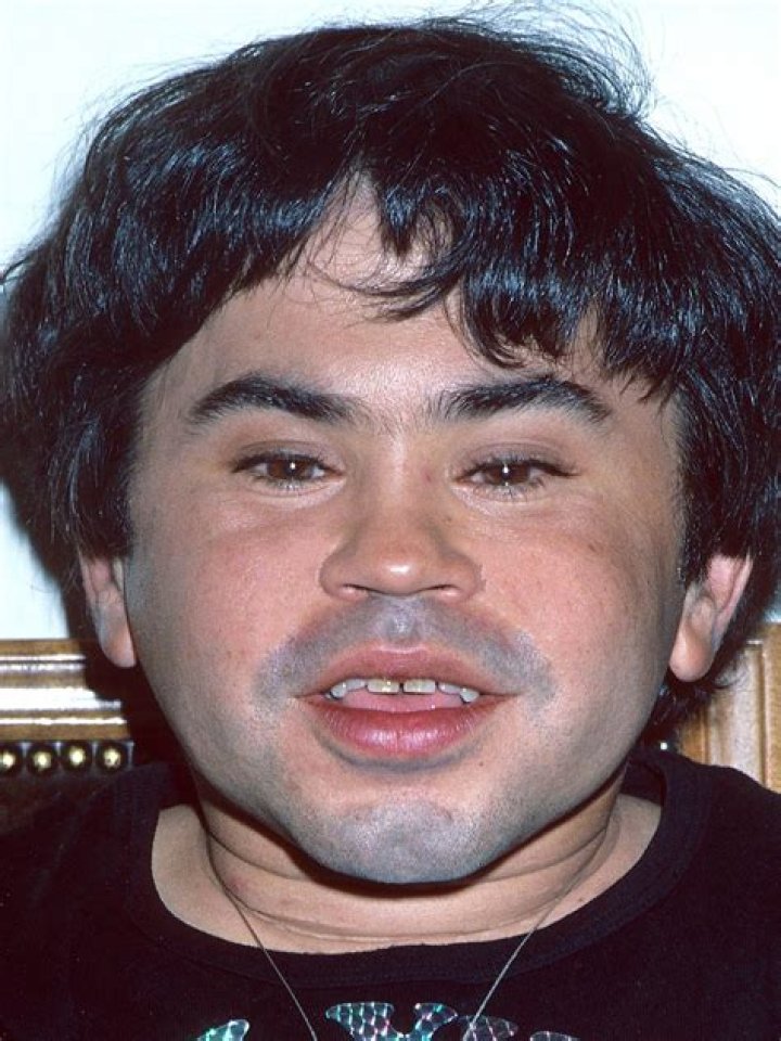 Herv&eacute; Villechaize: The Iconic Actor Who Left an Indelible Mark on Hollywood