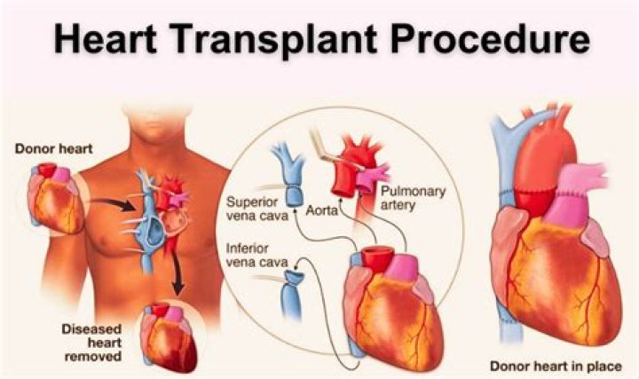How Long Does Denny Live After His Heart Transplant? Unveiling the Truth