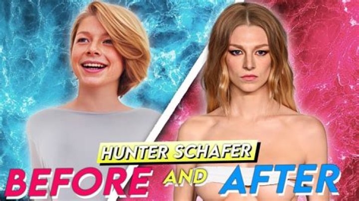 Hunter Schafer Surgery: Everything You Need to Know About Her Medical Journey