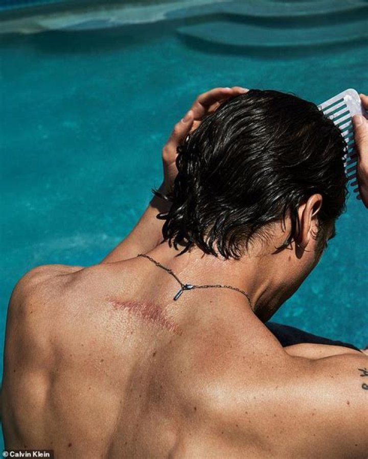 Jeremy Allen White Back Scar: Unveiling the Mystery Behind the Actor's Mark