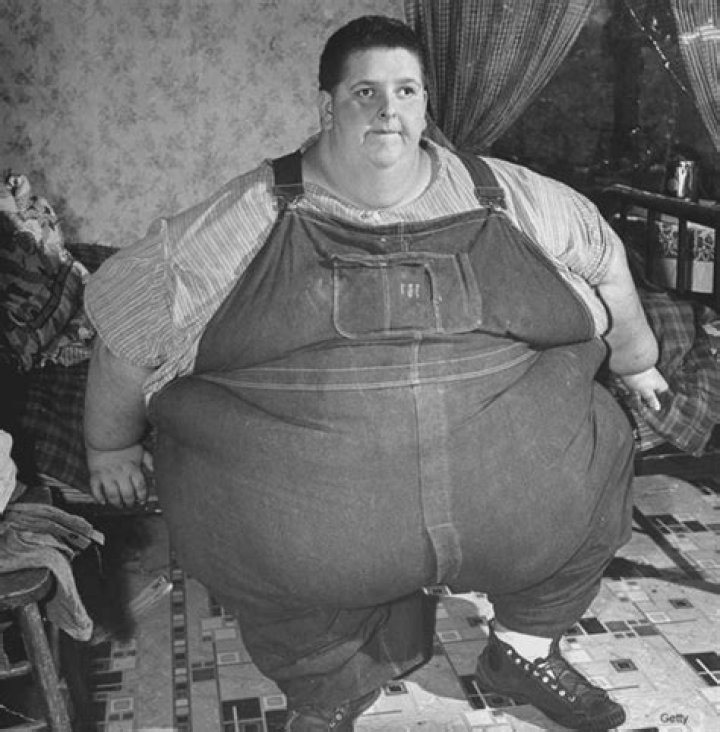 Understanding Jon Minnoch: The Story of the Heaviest Man in Medical History