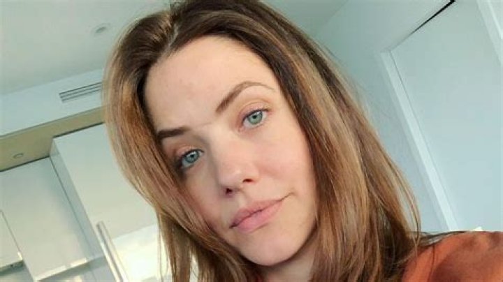 Julie Gonzalo Scars: Understanding the Journey and Impact