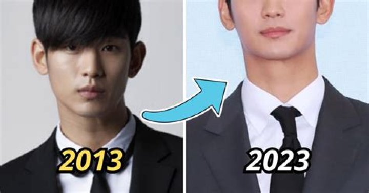 Kim Soo-hyun Surgery: Unveiling the Truth Behind the Transformation