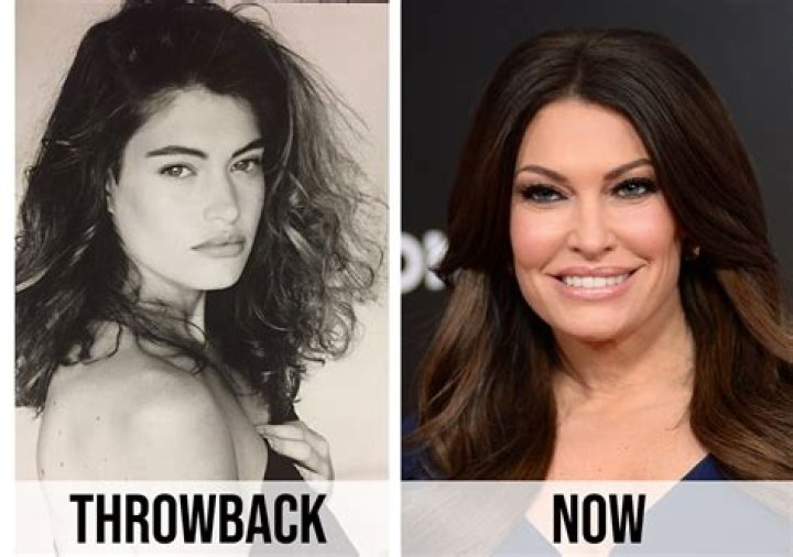 Kimberly Guilfoyle Before and After: A Comprehensive Transformation Journey