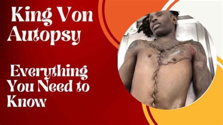 King Von Autopsy Details: Uncovering the Facts and Insights