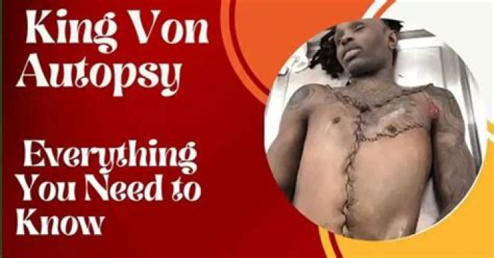 King Von Autopsy Real: Unveiling the Truth Behind the Tragic Loss