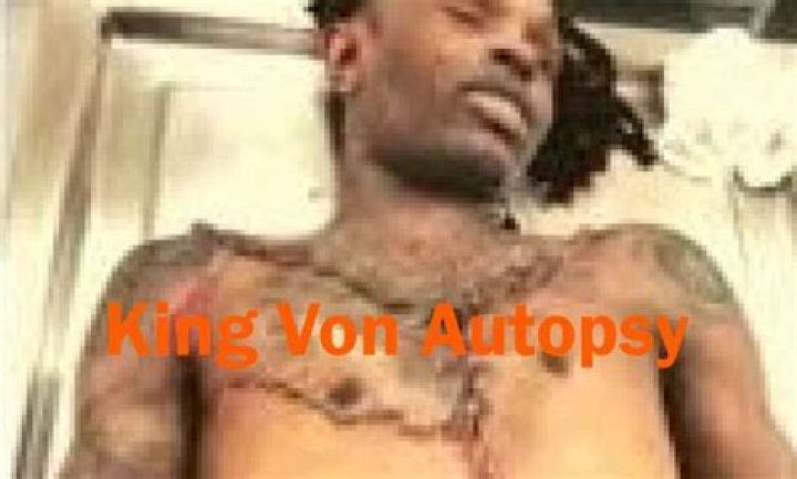 King Von's Autopsy: A Comprehensive Analysis of His Life and Untimely Death
