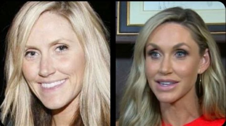 Lara Trump Before and After: A Comprehensive Look at Her Transformation and Impact