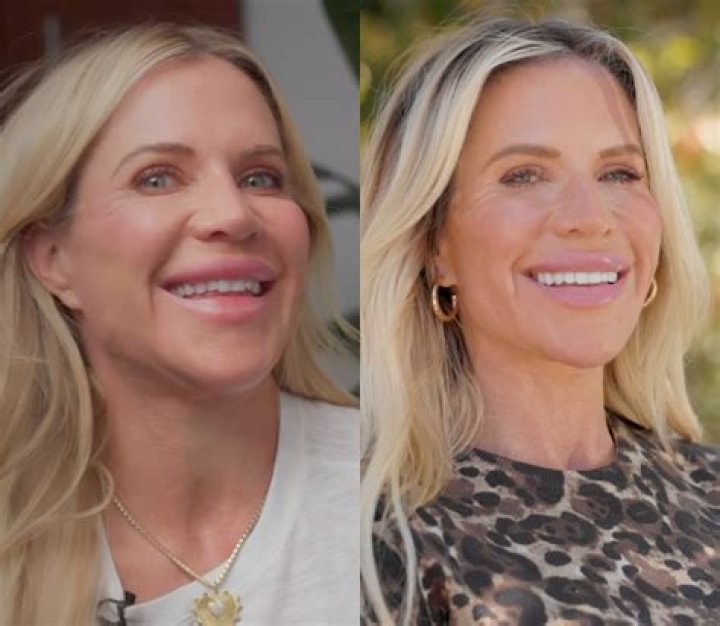 Lydia RHOC Teeth: The Journey, Transformation, and Insights