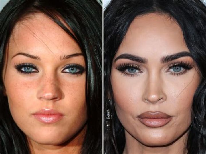 Megan Fox Before Plastic Surgery and After: A Comprehensive Look