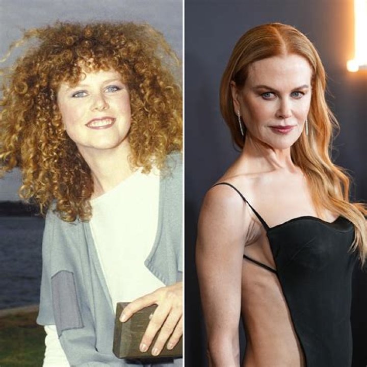 Nicole Kidman Before and After Plastic Surgery: Unveiling the Truth Behind the Transformation