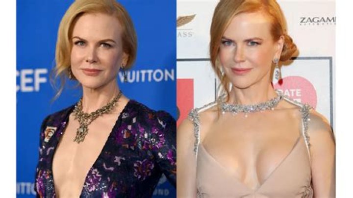 Nicole Kidman Implants: Exploring the Truth Behind the Rumors