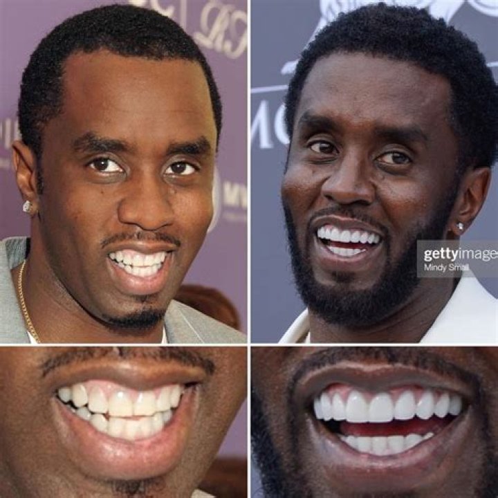 P Diddy Got Dolphin Teeth: The Fascinating Transformation of a Hip-Hop Icon