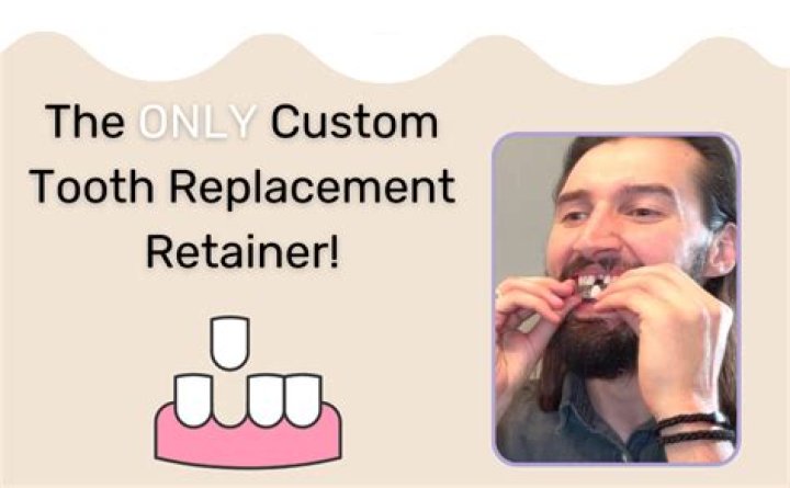 Temporary Replacement Part 1: A Comprehensive Guide to Understanding and Implementing Solutions