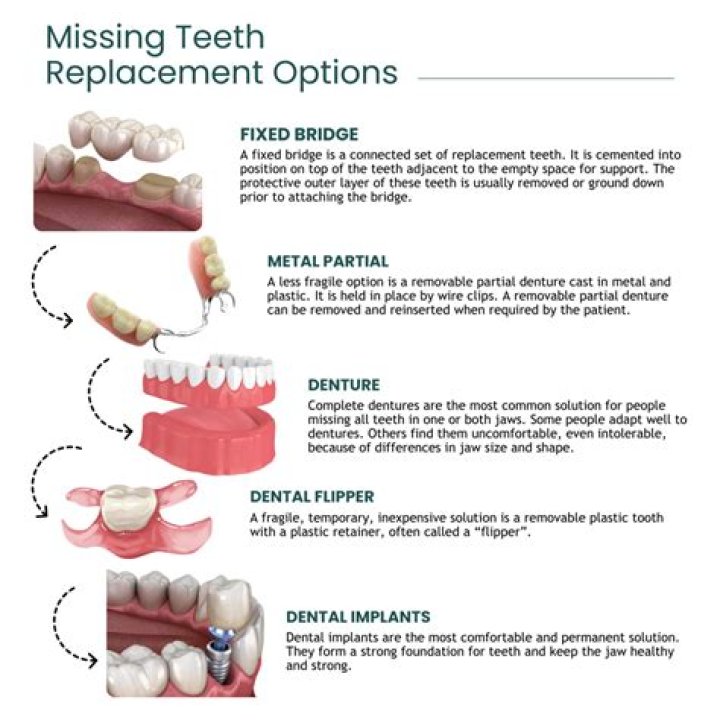 Temporary Replacement Pt 2: Comprehensive Guide for Businesses and Individuals