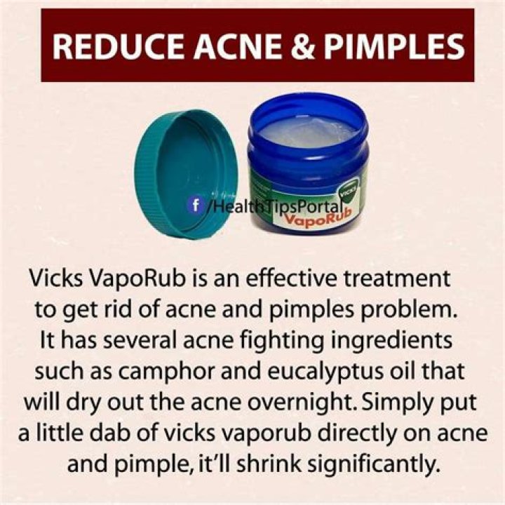 Vicks for Pimples: A Comprehensive Guide to Treating Acne Naturally