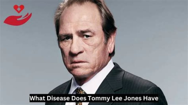 What Disease Does Tommy Lee Jones Have? Understanding His Health Journey