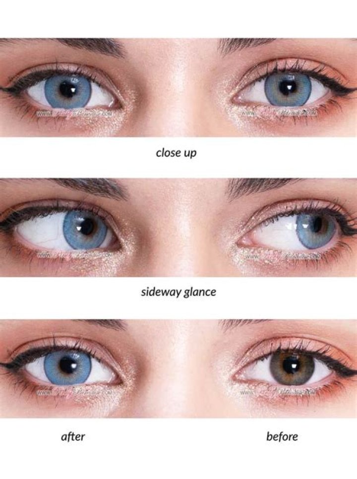 What Do Contact Lenses Feel Like? A Comprehensive Guide