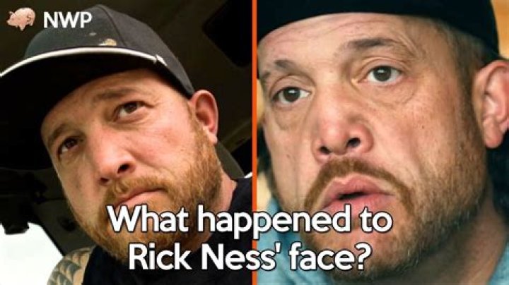 What Happened to Rick Ness's Face: The Truth Behind the Mystery