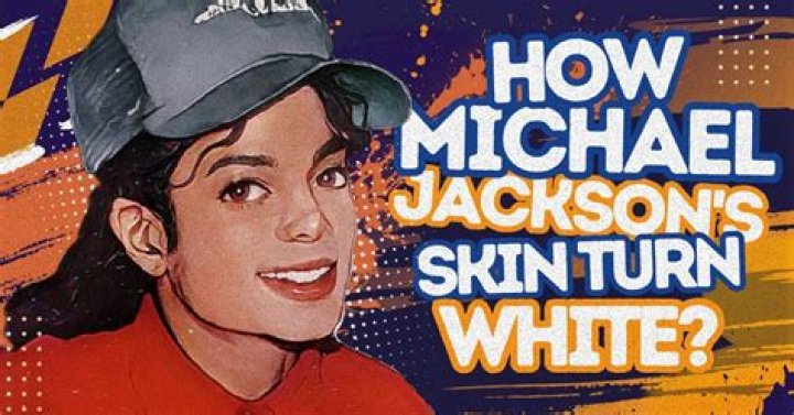 Why Did Michael Jackson Turn White: A Comprehensive Exploration