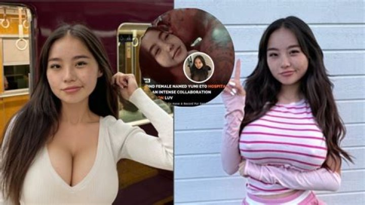 Yumi Eto Hospitalized: Understanding the News and Its Implications